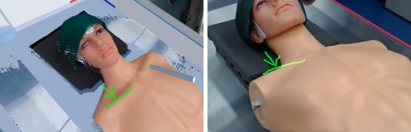 Expert annotating 3D patient reconstruction in VR (left) while novice sees annotations overlaid on real patient in AR (right)
