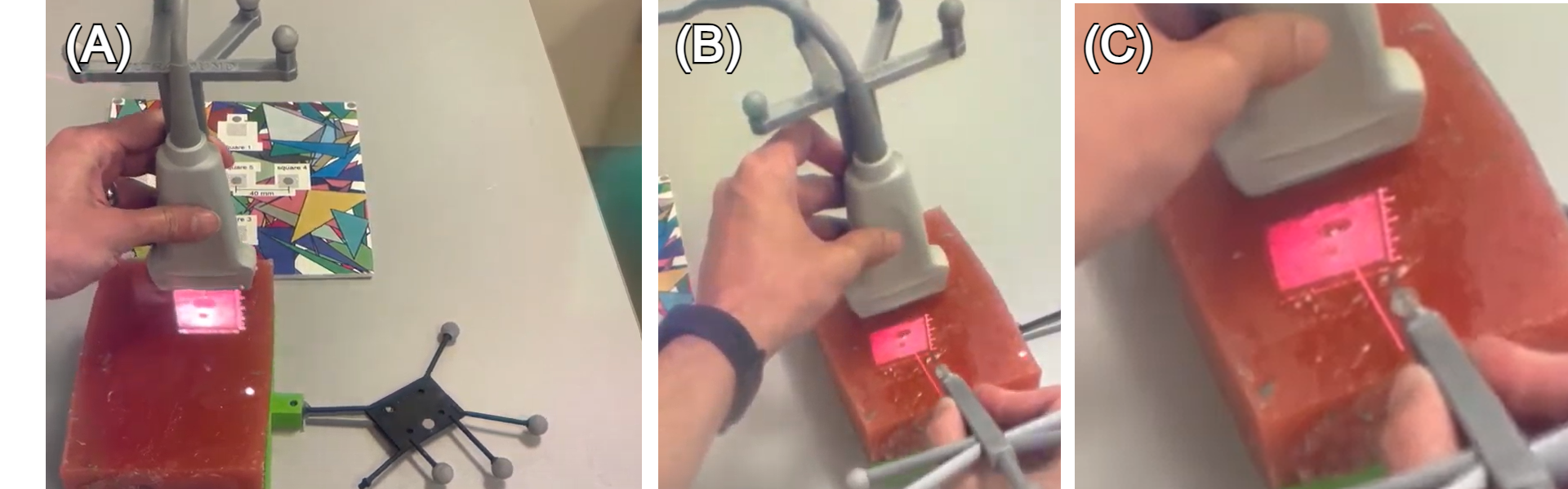 Three panels showing how needle visualization as a contextual cue helps users guide a needle even when the ultrasound display is misaligned: the raw situated view, the needle overlay, and a close-up showing both displays are skewed but still usable together