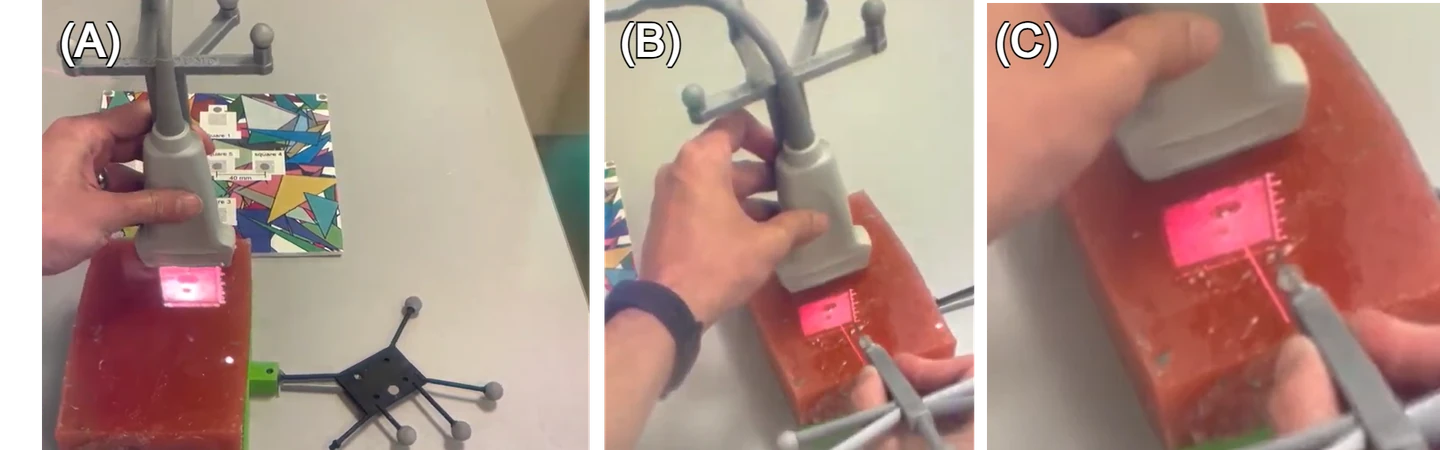 Three panels showing how needle visualization as a contextual cue helps users guide a needle even when the ultrasound display is misaligned: the raw situated view, the needle overlay, and a close-up showing both displays are skewed but still usable together